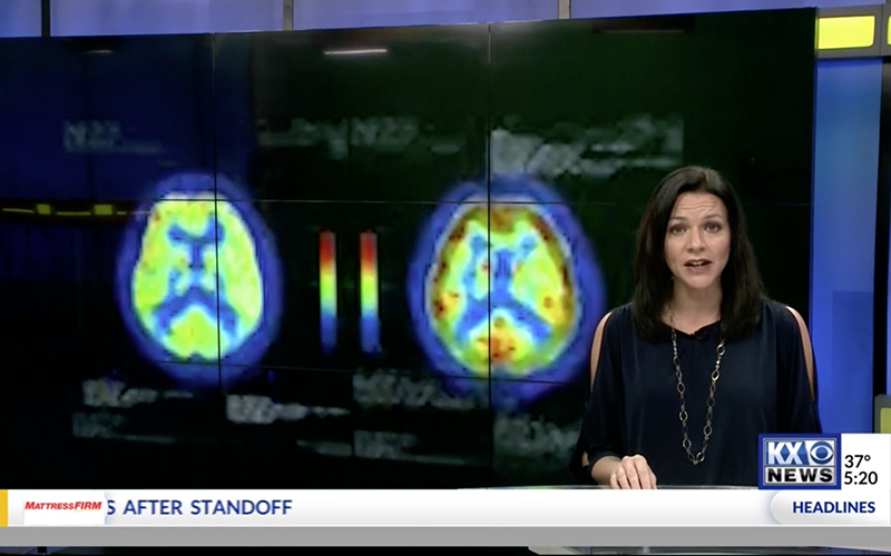 Alzheimers HBOT